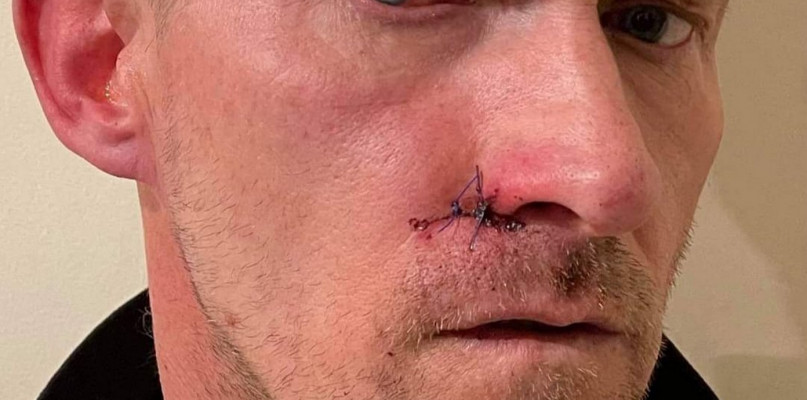 Poszukiwani sprawcy napadu pod siłownią